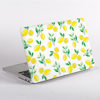 Yellow Lemons Pattern MacBook Case Side  | Available at Dessi-Designs.com